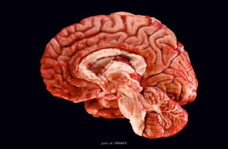 ثبت تصویر مغز انسان با وضوح بی سابقه